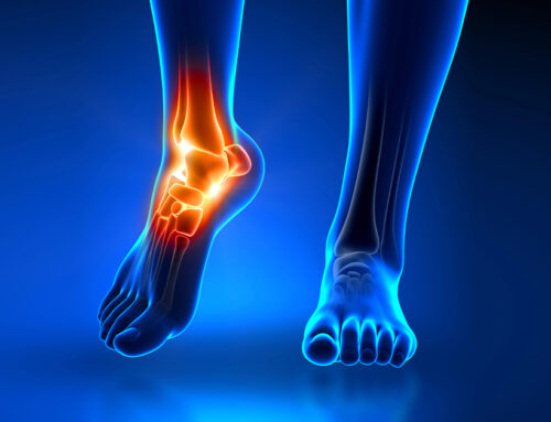 How Do I Know if My Ankle Fracture Is Serious?