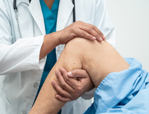How Long Does It Take to Recover from Total Knee Replacement?